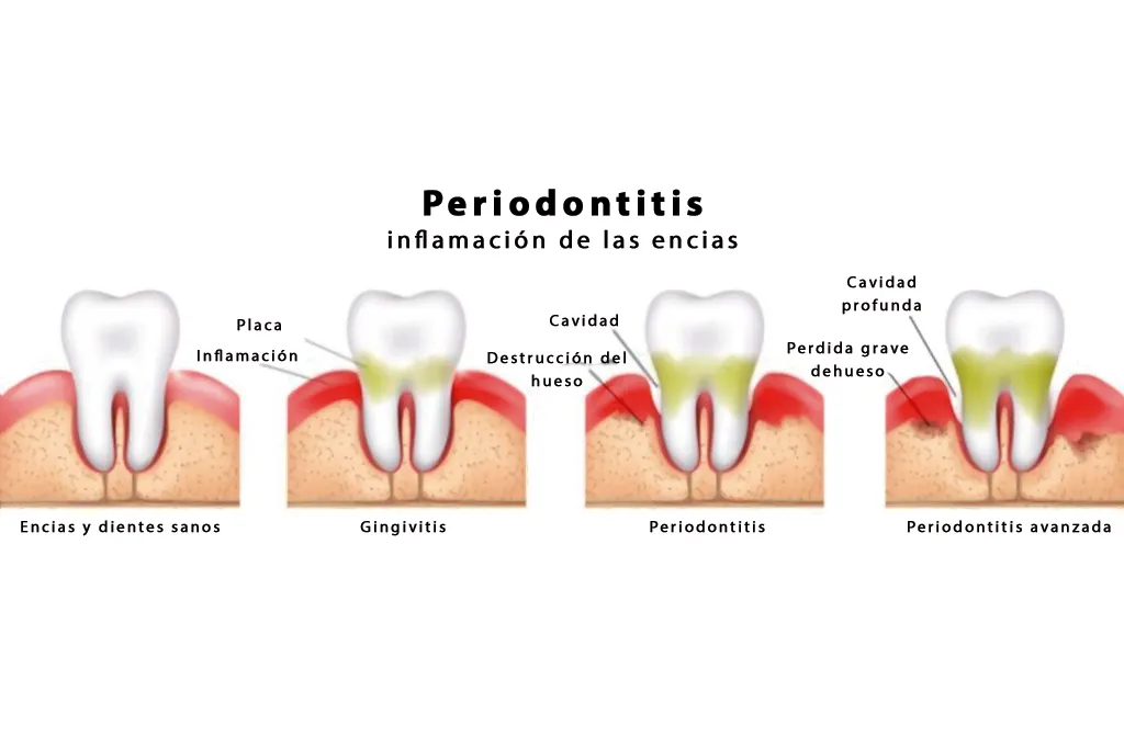 ortodoncia